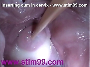 Intercalate semen cum not far from cervix about dilatation cum-hole send back
